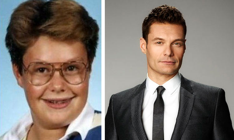 Ryan-Seacrest-Before-after