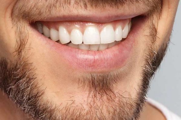 Como clarear os dentes naturalmente