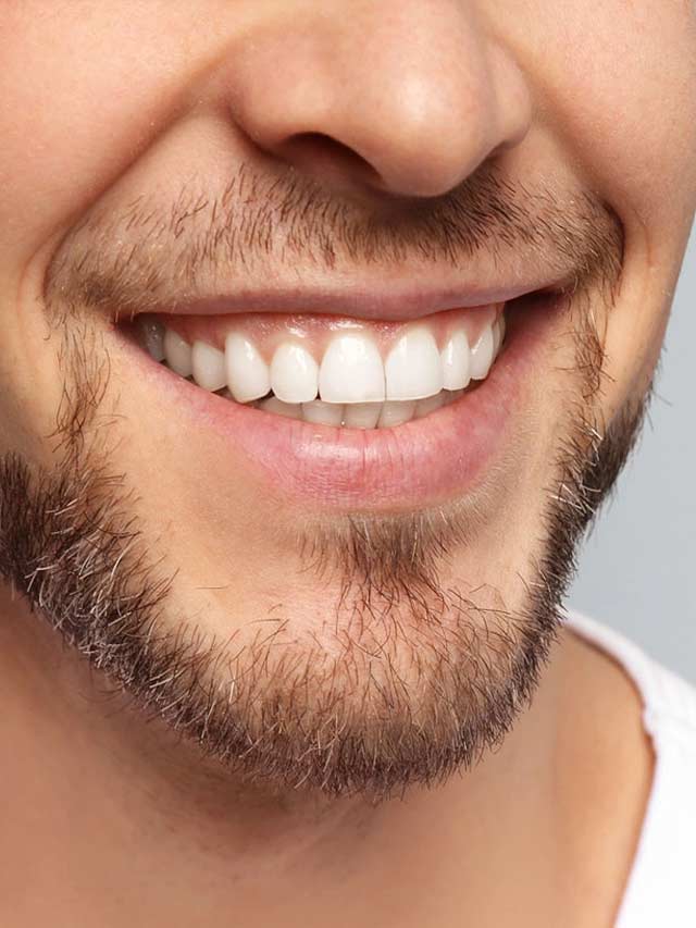 Como clarear os dentes naturalmente