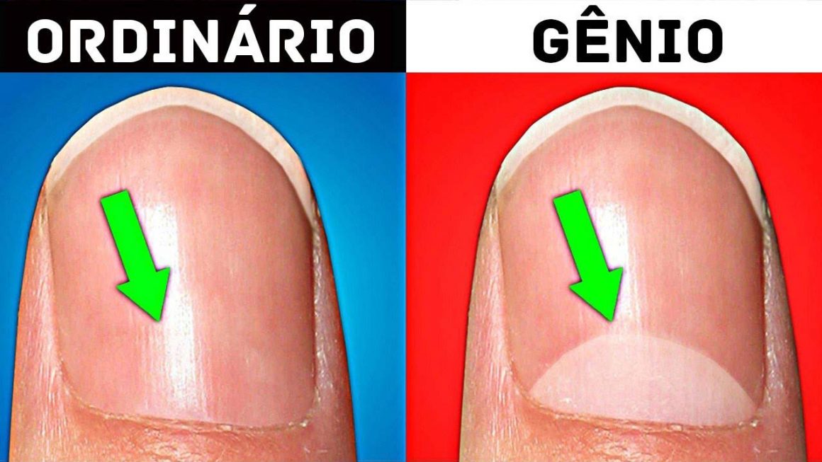 Sinal na unha pode identificar se você é gênio!