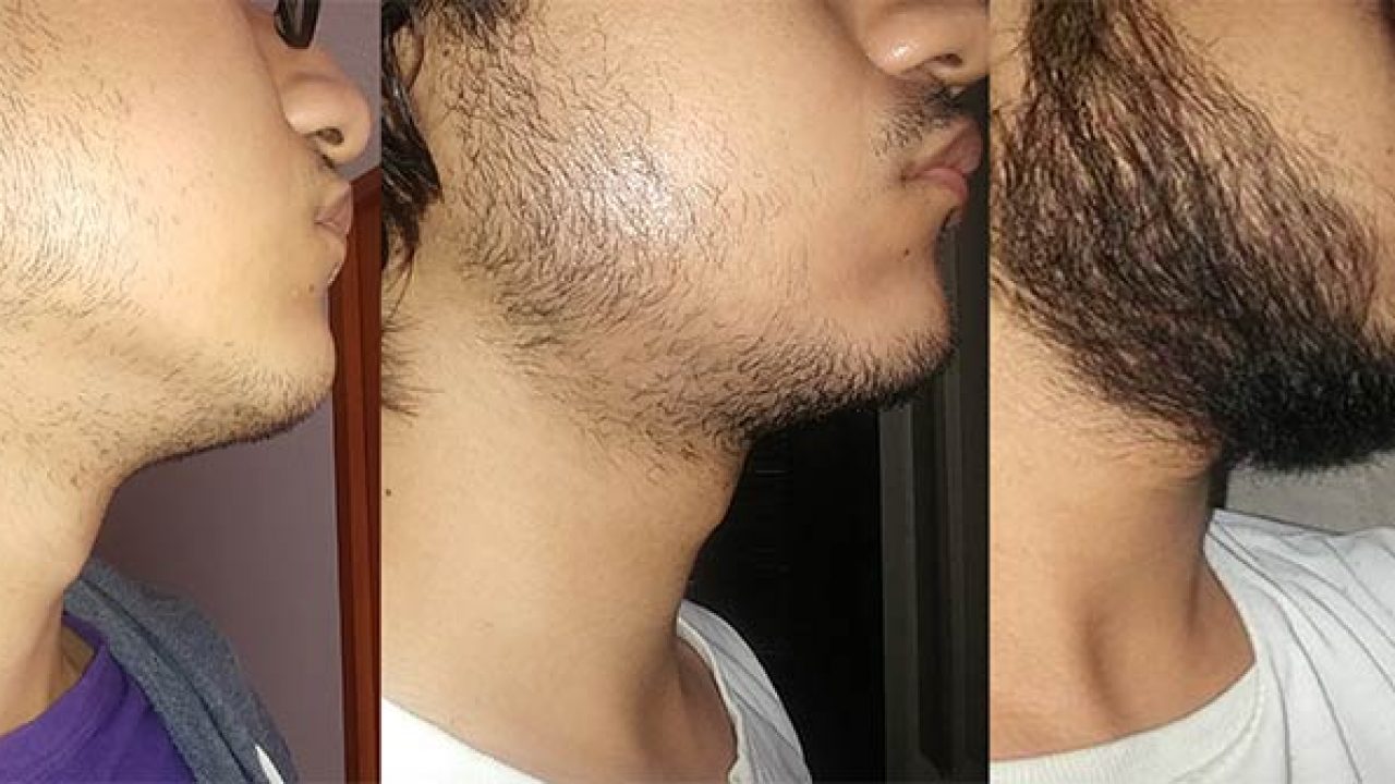 Minoxidil O Que e Como Usar Para Fazer Sua Barba Crescer Moda